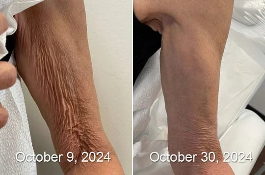 Posryst™ Botox Bee Venom Firming Serum Stick 25 10efbb919b25f8720f3a850fae1f1e3c7dde606e