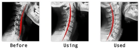 New Style Doctor's Recommended Cervical Pillow