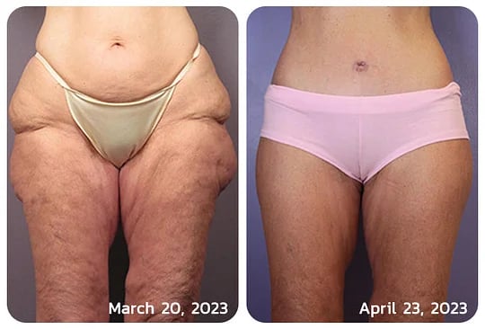 Posryst™ Botox Bee Venom Firming Serum Stick 38 40e80e5c345207f61b7b5097a4094c1ea2b22ef8