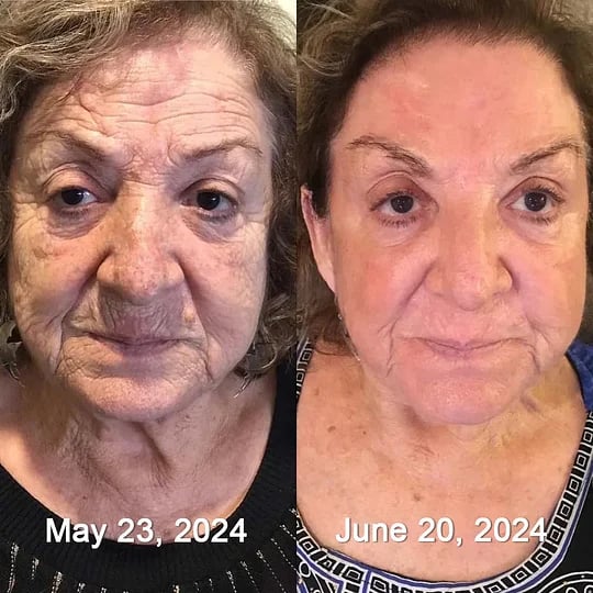 Posryst™ Botox Bee Venom Firming Serum Stick 26 4eb31babf8de5556a657795dde09f39334cc2797