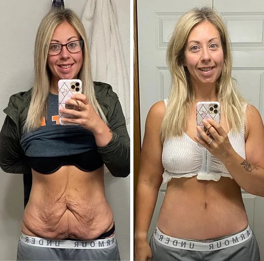 Posryst™ Botox Bee Venom Firming Serum Stick 24 9b8dad0becb4fb60bf2a873a0024b7ec73765311