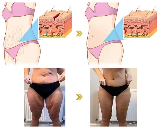 Posryst™ Botox Bee Venom Firming Serum Stick 34 d59d6598a62827dd3620b7ddd4ff561a7af36f75