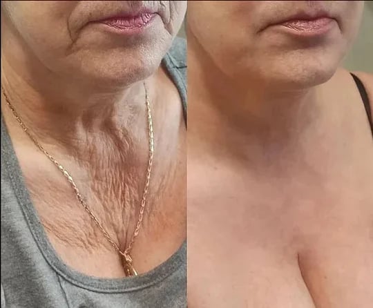 Posryst™ Botox Bee Venom Firming Serum Stick 23 e4d228f66bca26ff9fd887219be6b8d11f46f156